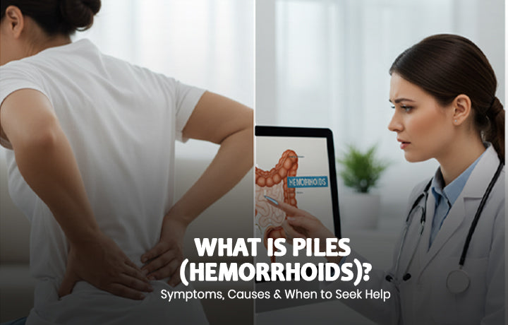 What is Piles (Hemorrhoids)? Symptoms, Causes & When to Seek Help